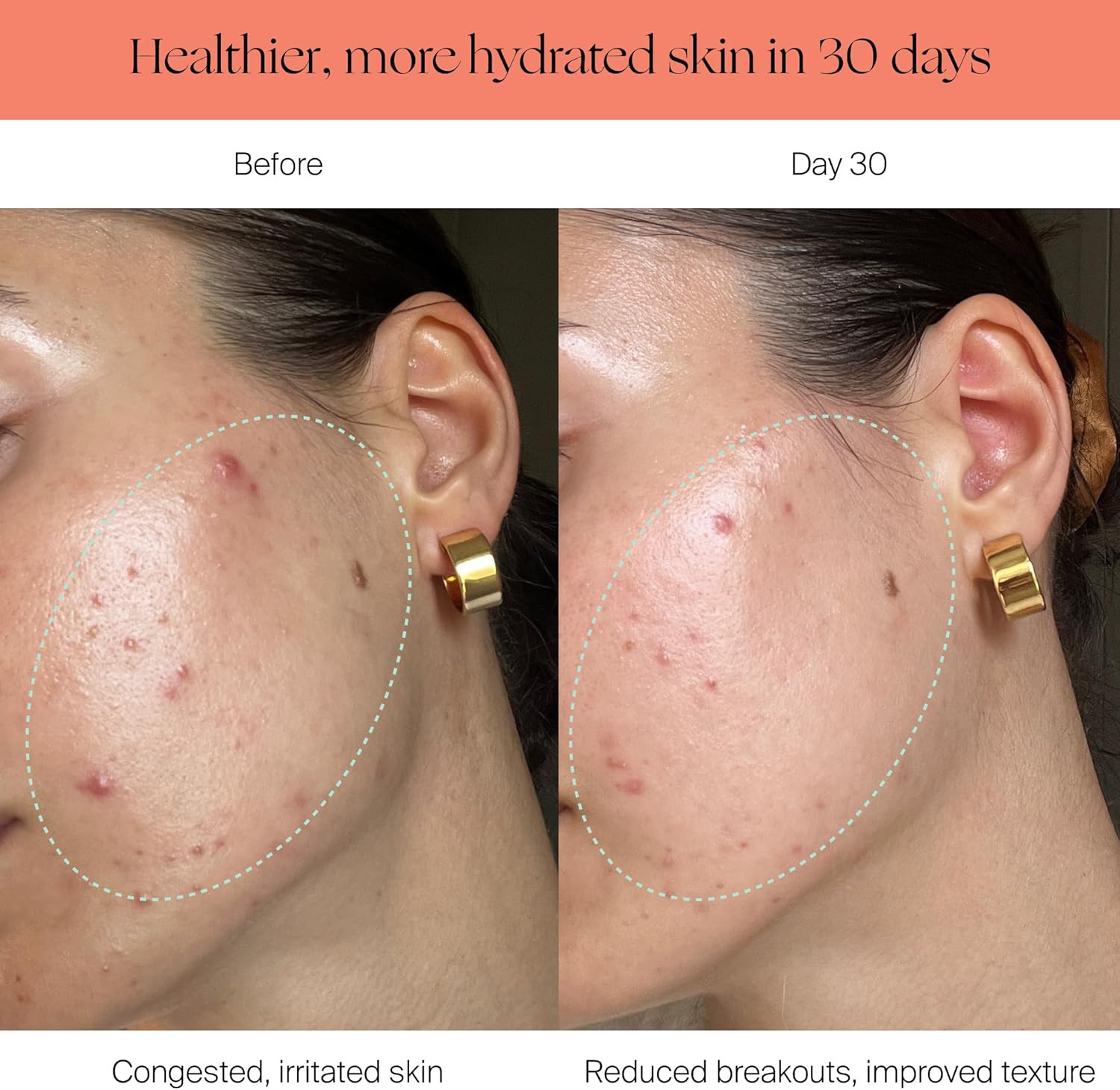 Canopy Filtered Shower Head - High Pressure Shower Head Filter for Hard Water - Shower Filter To Remove Impurities for Healthier Scalp, Skin & Hair - Reduce Dry Skin & Breakage - Black Shower Head