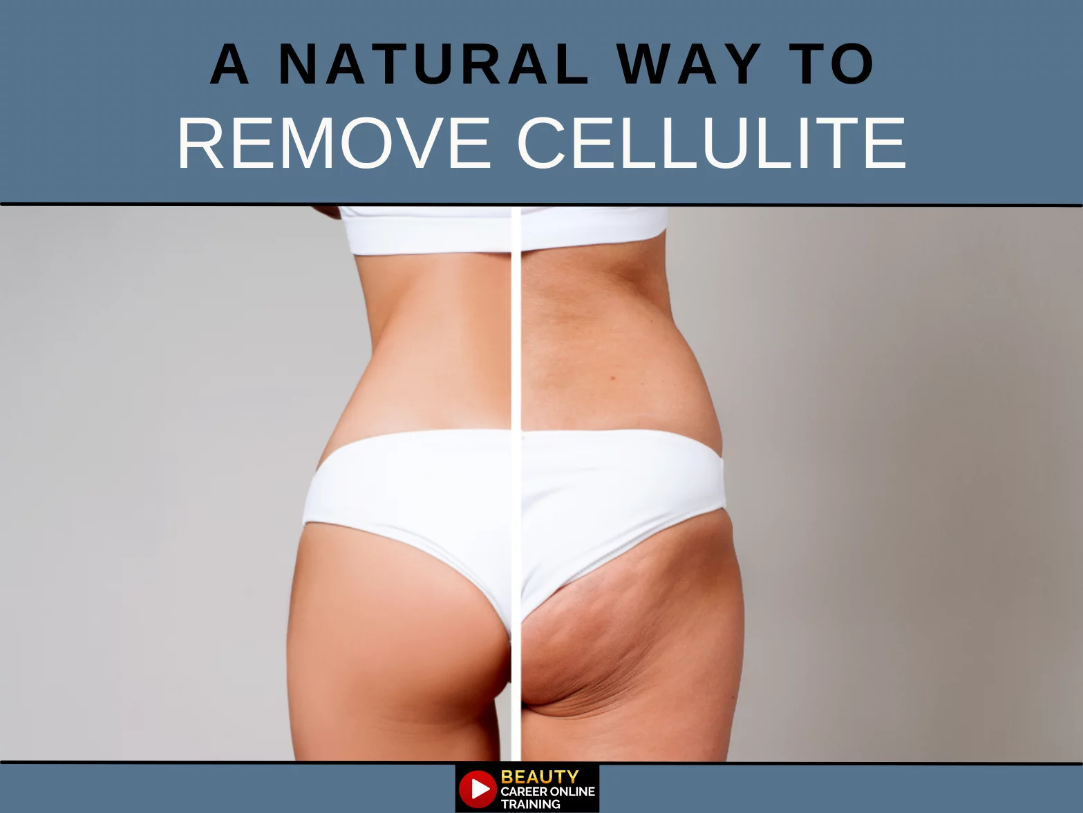 Create a Profitable Niche Business: Body Contouring Cellulite Treatment, Plasma Fibroblast, Job Skills, Training Bundle, USB [Online Activation Code]