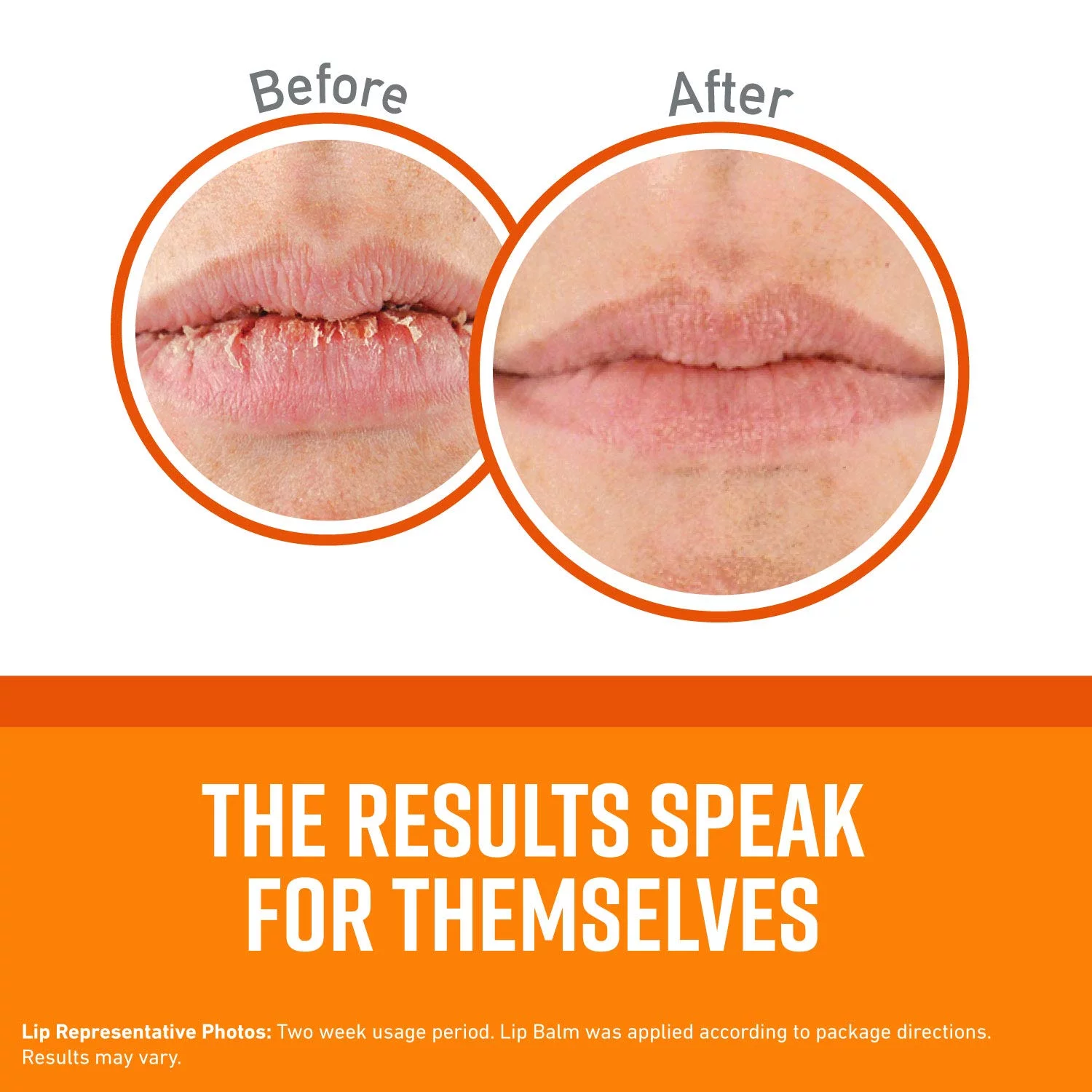 Unscented Repair Balm For Dry, Cracked s, Stick, (Pack Of 11)