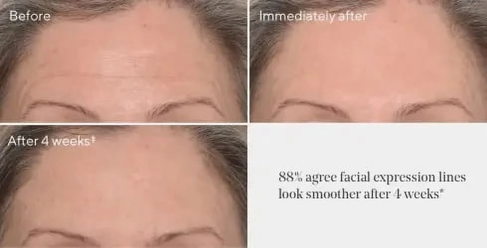 Murad Targeted Wrinkle Corrector, (2Piece Mini Size )3.25ml/net vol 0.11 fl oz