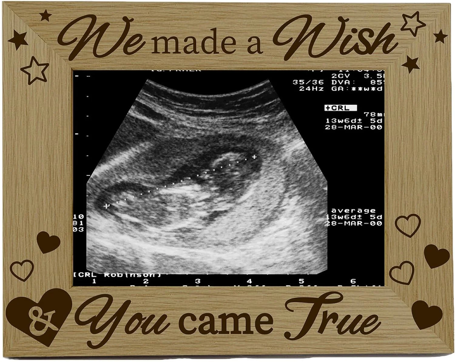 Ultrasound Picture Frame Sonogram Wood Photo Frames Engraved Display Tabletop Postcard Frame 4x6inch