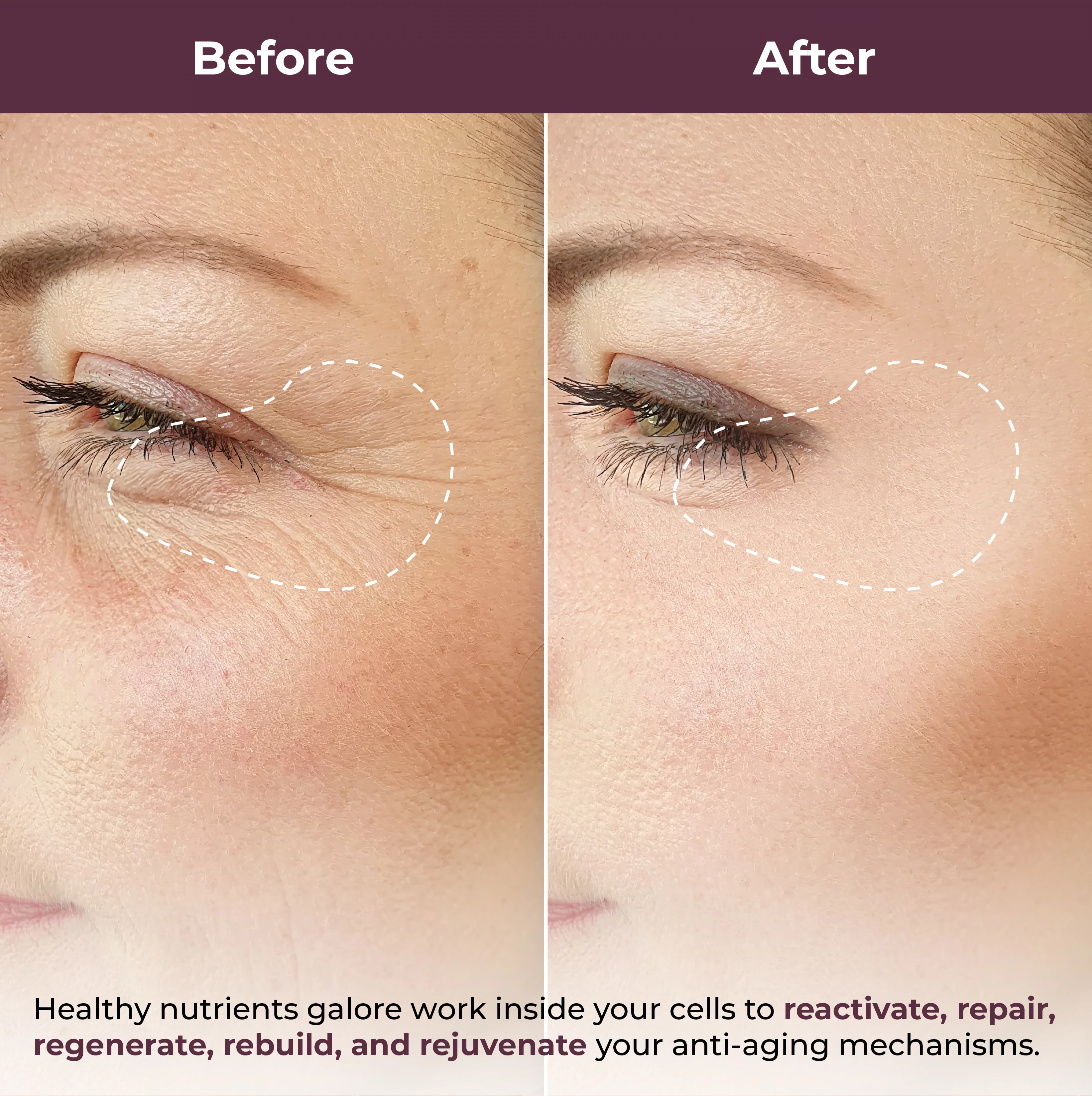 PURA Lift Instant Under Eye Serum - Advanced Dark Circle Reducer, Anti Aging Serum - Reduces Wrinkles, Under-Eye Puffy Bags, Fine Lines & Crow's Feet Instantly - Under Eye Instant Tightener, 3 Bottles