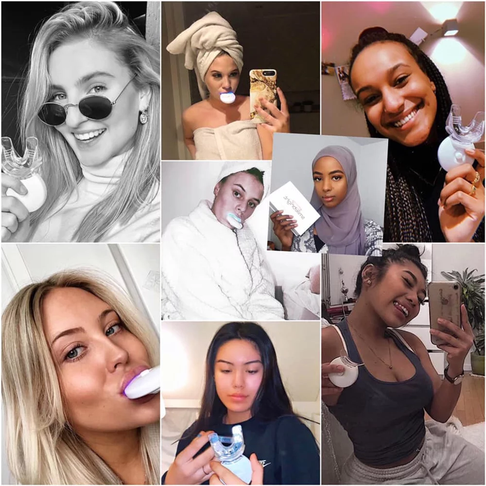 SmileBright 35% Carbamide Peroxide Teeth Whitening Kit w/ Light Tray, Strong Teeth Whitening Gel Coffee Tea Smoking Stain Removal