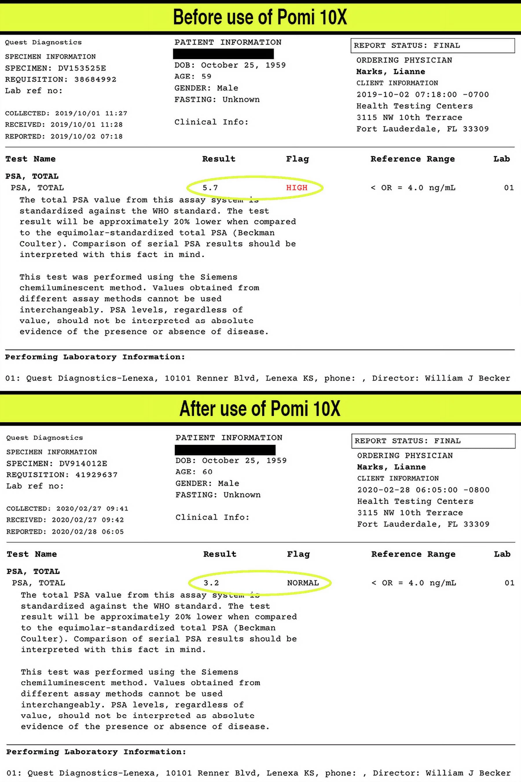 POMI 10X - 10 Times Stronger Than The Competition! - Lower PSA Levels - See Our LAB Results! - 100% Natural Ingredients: Pomegranate, Green Tea, Turmeric, Broccoli - Vegan Capsules (60ct)