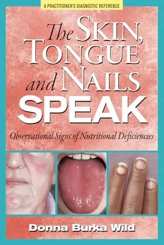 Pre-Owned: The Skin, Tongue and Nails Speak: Observational Signs of Nutritional Deficiencies (Paperback, 9780615601212, 0615601219)