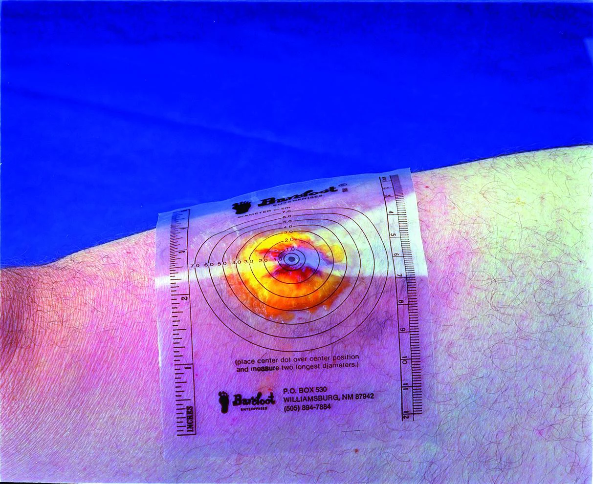 Measuring Guide Wound Display [Sold by the Box, Quantity per Box : 250 EA, Category : Miscellaneous DME Supplies, Product Class : Miscellaneous DME]